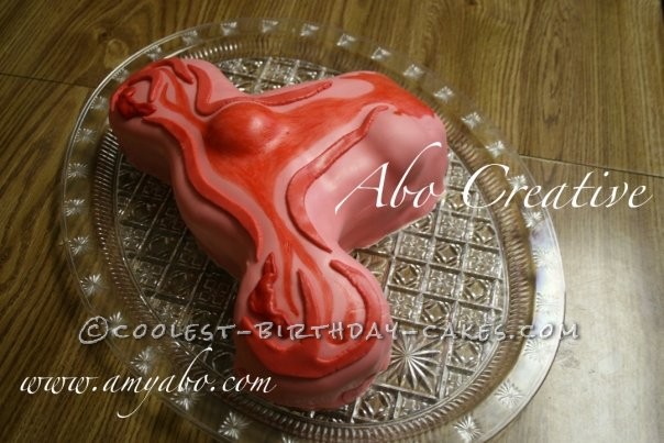 Fibroid Surgery? Who Makes a Cake for That? Uterus Cake!